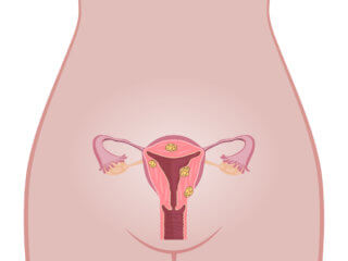 筋腫 妊娠 中 子宮 【医療監修】妊娠中の子宮筋腫のリスク。分娩方法や産後の注意点 [ママリ]